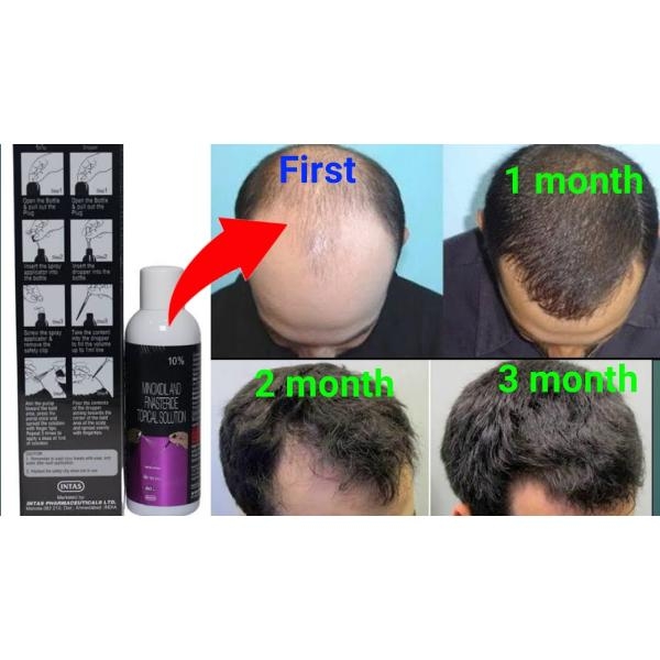 Morr F 10% Minoxidil & Finastride Lipid Solution For Topical Application  60ml | Wellsell BD